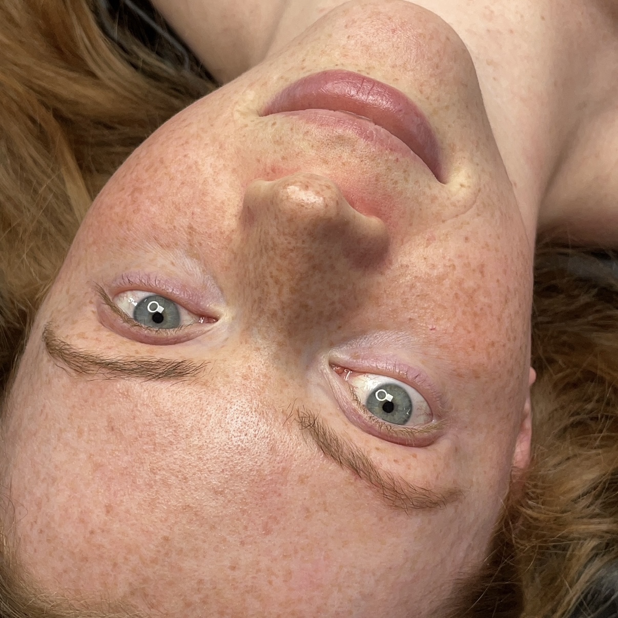 Junge Frau mit verheilten Sommersprossen